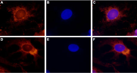 Expression of TRPV4 in rat DRG primary culture Immunocytochemical staining of paraformaldehyde-fixed and permeabilized rat dorsal root ganglion (DRG) primary culture. A, D. Staining using Anti-TRPV4 antibody (#WGA1235), (1:500), followed by goat anti-rabbit-AlexaFluor-555 secondary antibody. B, E. Nuclear staining of cells using the cell-permeable dye Hoechst 33342. C. Merged image of panels A and B. F. Merged image of panels D and E.