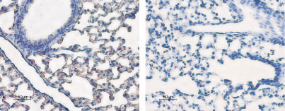 Expression of Aquaporin 5 in rat lung Immunohistochemical staining of rat lung sections using Anti-Aquaporin 5 antibody (#WGA1053), (left panel). The strong staining in the alveoli (red brown) is consistent with type 1 pneumocytes (arrows). Counterstain of cell nuclei appears blue. A negative control is shown in the right panel.