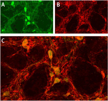 Expression of ASIC1 in rat brain Immunohistochemical staining of rat globus pallidus using Anti-ASIC1 antibody (#WGA1152). A. Parvalbumin (PV) positive neurons are shown (green). B. Neurons with typically enmeshed dendritic trees stain intensely for ASIC1 (red). C. double labeling with mouse anti-Parvalbumin (green) reveals strong co-localization of PV with ASIC1.