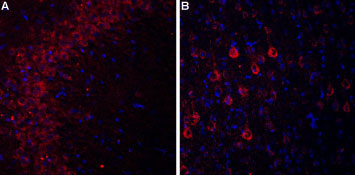 Expression of Cavα2δ3 in rat hippocampus and cortex Immunohistochemical staining of rat hippocampal CA3 region (A) and rat neocortex (B) using Anti-Cavα2δ3 (extracellular) antibody (#WGA1247). In both areas Cavα2δ3 staining (red) appears in pyramidal neurons (arrow). DAPI is used as the counterstain (blue).