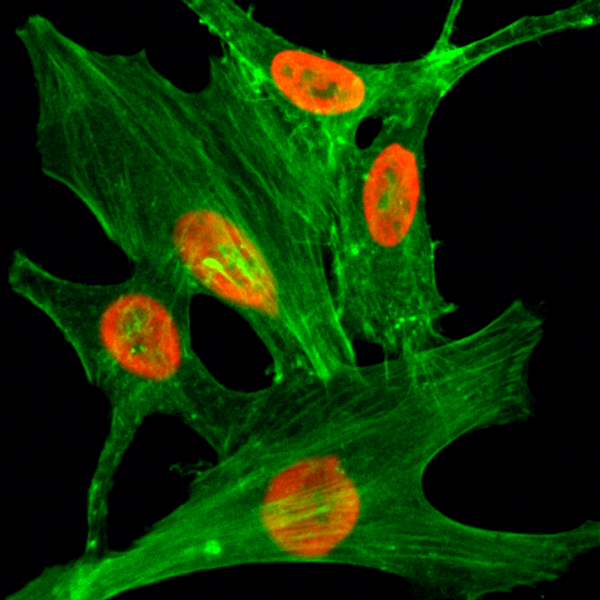 Immunocytochemical staining of HeLa cells treated<code><br /></code> with sodium butyrate, using anti-Acetyl-Histone <code><br /></code> H2A.Z (Lys4) Rabbit Monoclonal Antibody (clone <code><br /></code> RM221) (red). Actin filaments have been labeled <code><br /></code> with fluorescein phalloidin (green).<code><br /></code>