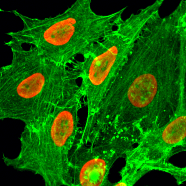 Immunocytochemical staining of HeLa cells treated<code><br /></code> with sodium butyrate, using anti-Acetyl-Histone <code><br /></code> H2B (Lys20) Rabbit Monoclonal Antibody (clone <code><br /></code> RM235) (red). Actin filaments have been labeled <code><br /></code> with fluorescein phalloidin (green).<code><br /></code>
