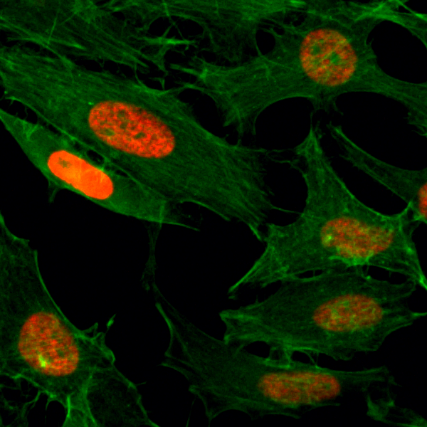 Immunocytochemistry of HeLa cells treated with<code><br /></code>sodium butyrate, using Acetyl-Histone H3 (Lys4) <code><br /></code>Rabbit mAb RM149 (red). Actin filaments have<code><br /></code>been labeled with fluorescein phalloidin (green).<code><br /></code>