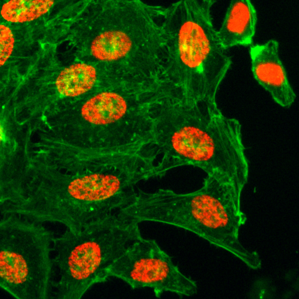 Immunocytochemistry of HeLa cells treated with<code><br /></code>sodium butyrate, using Acetyl-Histone H3 (Lys18) <code><br /></code>Rabbit mAb RM166(red). Actin filaments have<code><br /></code>been labeled with fluorescein phalloidin (green).<code><br /></code>