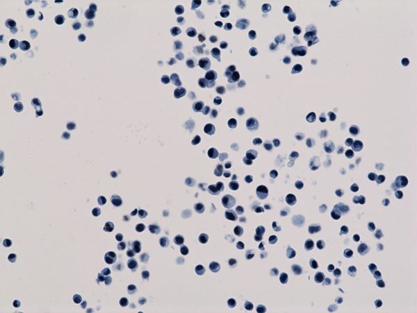 Immunohistochemistry staining of HepG2 cells using<code><br /></code> Anti-Acetyl-Histone H3 (Lys18) antibody, RM166.<code><br /></code>