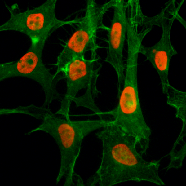 Immunocytochemistry of HeLa cells treated with<code><br /></code>sodium butyrate, using Acetyl-Histone H3 (Lys56) <code><br /></code>Rabbit mAb RM179 (red). Actin filaments have<code><br /></code>been labeled with fluorescein phalloidin (green).<code><br /></code>