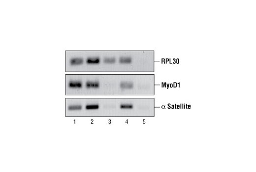 Chromatin immunoprecipitations were performed using digested chromatin from HeLa cells and either Histone H3 (D2B12) XP ® Rabbit mAb (ChIP Formulated) #4620 (lane 2), Rpb1 CTD (4H8) Mouse mAb #2629 (lane 3), Di-Methyl Histone H3 (Lys9) Antibody #9753 (lane 4), or Normal Rabbit IgG #2729 (lane 5). Purified DNA was analyzed by standard PCR methods using SimpleChIP ® Human RPL30 Exon 3 Primers #7014, SimpleChIP ® Human MyoD1 Exon 1 Primers #4490, and SimpleChIP ® Human α Satellite Repeat Primers #4486. PCR products were observed for each primer set in the input sample (lane 1) and various protein-specific immunoprecipitations, but not in the immunoprecipitation using Normal Rabbit IgG #2729 (lane 5).