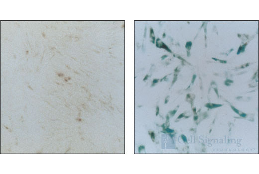 β-Galactosidase staining at pH 6 on normal WI38 cells at population doubling 29 (left) and senescent WI38 cells at population doubling 36 (right).