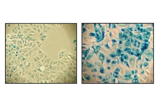Β-Galactosidase staining at pH 6.0 on MCF-7 cells untreated (left) and senescent MCF-7 cells treated with etoposide #2200 (12.5 μM, 24 hr) and allowed to recover for 4 days (right).