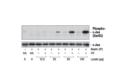 SAPK-induced phosphorylation of c-Jun was measured by quantitative immunoblotting using Phospho-c-Jun (Ser63) Antibody (upper) and c-Jun (L70B11) Mouse mAb #2315 (lower). Lysate titrations were performed by immuoprecipitating phospho-SAPK/JNK from the indicated amounts of HeLa cell extracts, untreated or UV-treated. Phosphorylation of c-Jun at Ser63 is observed in UV-treated lysates.