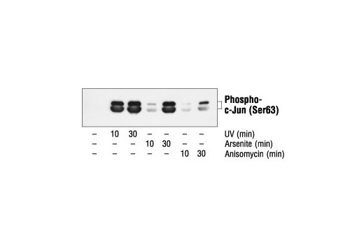 SAPK/JNK activity of UV, arsenite and anisomycin-treated SK-N-MC cell extracts was analyzed by IP/Kinase assay. Phosphorylation of c-Jun at Ser63 was visualized by immunoblotting with Phospho-c-Jun (Ser63) Antibody
