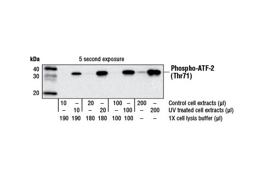 Analysis of p38 MAP Kinase activity of UV-treated NIH-3T3 cells by western blot using Phospho-ATF-2 (Thr71) Antibody. Cell extracts were incubated overnight with Immobilized p38 MAPK (Thr180/Tyr182) mAb. Kinase reaction was performed in the presence of 100 µM of cold ATP and 1 µg of ATF-2 fusion protein. Phosphorylation of ATF-2 at Thr71 was measured by western blot using Phospho-ATF-2 (Thr71) Antibody.