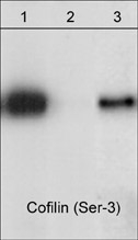 ARG20528 anti-cofilin phospho (Ser3) antibody WB image Western Blot: Jurkat cells 1) untreated or 2,3) treated with lambda phosphatase, 3) the phosphatase was inhibited with phospho-Cofilin 1 (Ser3) peptide. The blots were stained with ARG20528 anti-cofilin phospho (Ser3) antibody.