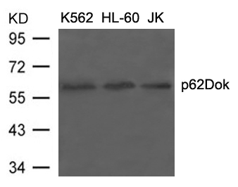 ARG51242 anti-p62 Dok antibody WB image Western Blot: extracts from K562, HL-60 and JK cells stained with anti-p62Dok antibody ARG51242.