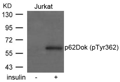 ARG51757 anti-p62 Dok phospho (Tyr362) antibody WB image Western Blot: extracts from Jurkat cells untreated or treated with insulin stained with anti-p62Dok (phospho Tyr362) antibody ARG51757.