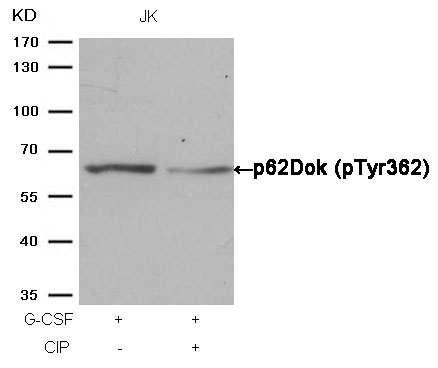 ARG51757 anti-p62 Dok phospho (Tyr362) antibody WB image Western Blot: extracts from JK cells, treated with G-CSF or calf intestinal phosphatase (CIP), stained with anti-p62Dok (phospho Tyr362) antibody ARG51757.