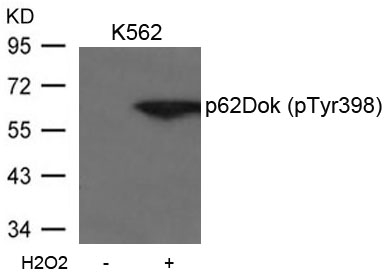 ARG51758 anti-p62 Dok phospho (Tyr398) antibody WB image Western Blot: extracts from K562 cells untreated or treated with H2O2 stained with anti-p62Dok (phospho Tyr398) antibody ARG51758.