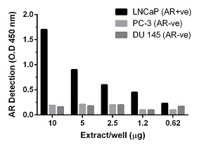 Monitoring protein expression levels of Androgen Receptor using ab128498.Different amounts of nuclear extracts from three Human prostate cancer cell lines: LnCaP, PC-3 and DU145 were analyzed for levels of Androgen Receptor protein. This data is provided for demonstration only. 