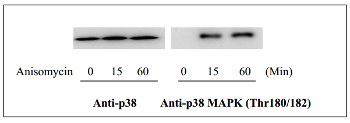 Western blot analysis of extracts from 1 µg/ml Anisomycin treated HeLa cells. Phospho-p38 MAPK (Thr180/Tyr182) and Anti-p38 MAPK antibodies from ab126425 were used in both detection assays.
