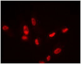 The SIRT1 detector antibody (ab110304) in this ELISA is available as standalone antibody. In this image Immunocytochemistry of the antibody (ab110304) from this ELISA used to stain Human HDFn cells.