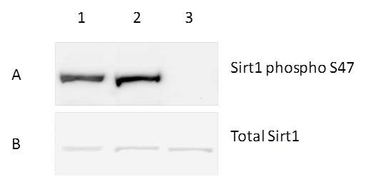 The detector antibody used in this kit specifically detects the phosphorylated SIRT1 as determined by Western blotting. Hek293T extracts were left untreated (lane 1), treated with heat only (lane 2) or treated with 1:100 dilution of λ Ppase at 34˚C (lane 3). Samples were then diluted in SDS-PAGE buffer and loaded at 30 µg/well. Membranes were blocked with the kit’s blocking reagent at 1X concentration and incubated with either the detector antibody against SIRT1 phospho S47 (A) or the capture antibody against total SIRT1 (B) and label with secondary antibodies conjugated to HRP. λ Ppase completely dephosphorylates SIRT1 without affecting the protein levels.
