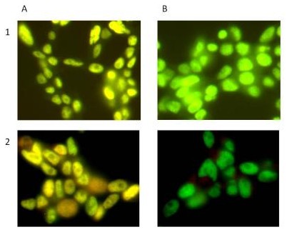 Figure 3. Specificity of Signal by Immunocytochemistry. Hek293T cells were seeded on glass coverslips and allowed to adhere overnight. Levels of SIRT1 and phosphorylated protein at S47 were measured after permeabilizing with 0.1% Triton (Panel 1) and methanol (Panel 2) followed by Lambda phosphatase treatment (Panel B). The total SIRT1 signal was labeled with GAM-488 and the SIRT1 pS47 with GAR-594. Panel B shows a reduction in phosphorylation due to LP treatment.