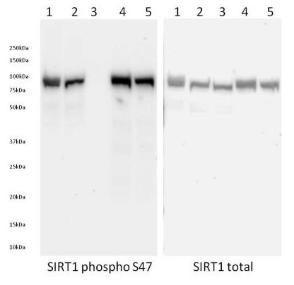 Figure 4. Specificity of signal by Western Blot. Western Blot was run on a 4-15% gradient acrylamide gel. Samples were loaded as follows from left to right: (1) 40 µg of control Hek293T cell extract, (2) 40 µg of mock treated Hek293T cell extract, (3) 40 µg of 1:100 LP treated Hek293T cell extract, (4) 40 µg of 50 nM calyculin treated Hek293T cell extract and (5) 40 µg of 0.5% DMSO treated Hek293T cell extract. Membrane blocking (1 hour RT), primary antibody incubation (overnight 4ᵒC) and secondary antibody incubation (2 hours RT) were all carried out with 1X block (ab126587) in PBS + 0.05% Tween.