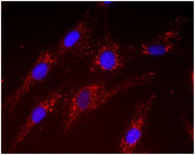 Figure 5. The SOD2 detector antibody in this ELISA is available as standalone antibody ab110300. Immunocytochemistry image of Abcam ab110300 stained human HDFn cells. Target protein localizes to the mitochondria.