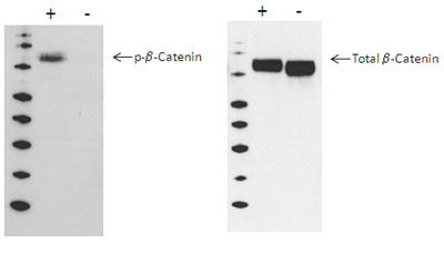 Using Western blot, beta-catenin phosphorylation at Ser45 is detected in PMA/calyculin-treated A549 cells (+), compared with untreated A549 cells (-).
