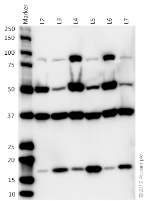 All blocking and antibody incubation steps were done in 5% milk, 20 mM Tris-HCl, 0.1% TWEEN-20. All lanes : Anti-Sodium Potassium ATPase antibody – Plasma Membrane Marker Anti-ATP5A antibody – Mitochondrial Marker Anti-GAPDH antibody – Cytosolic Marker Anti-Histone H3 (di methyl K9) antibody – Nuclear Marker Lane 1 : Marker Lane 2 : Human heart homogenate Whole Tissue Lysate - 20 µg Lane 3 : HeLa Whole Cell Lysate - 20 µg Lane 4 : Mouse heart homogenate Whole Tissue Lysate - 20 µg Lane 5 : NIH-3T3 Whole Cell Lysate - 20 µg Lane 6 : Rat heart homogenate Whole Tissue Lysate - 20 µg Lane 7 : H9C2 Whole Cell Lysate - 20 µg Secondary: ab131368 at 1/1000 dilution.