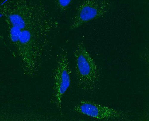 Immunocytochemical staining of Human HeLa cells using the catalase detector antibody in this kit (ab110292). The target protein locates mainly in peroxisomes.