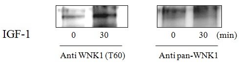 HeLa cells were treated or untreated with IGF-1 (50ng/ml) for 30 min. Cell lysates were analyzed using this phosphoELISA and Western Blot.