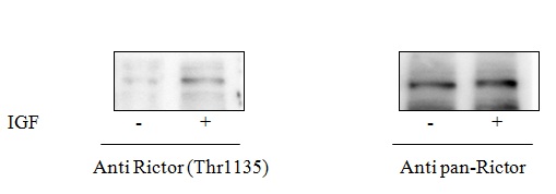 Rictor (Thr1135) - Western Blot