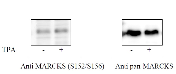 COS cells were treated or untreated with TPA. Cell lysates were analyzed using this phosphoELISA and Western Blot.