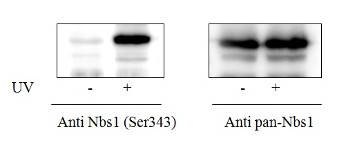T47D cells were treated or untreated with UV. Cell lysates were analyzed using this phosphoELISA and Western Blot.