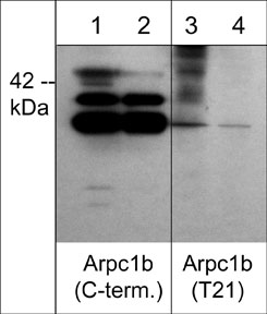 Western blot of Arpc1b phosphorylation in A431 stimulated with calyculin A (100 nM) for 30 min (lanes 1 & 3). The blots were treated with lambda phosphatase to remove phosphorylation (lanes 2 & 4), then probed with anti-Arpc1b (C-terminal region) (lanes 1 & 2) or anti-Arpc1b (Thr-21) (lanes 3 & 4).