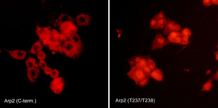 Immunocytochemical labeling of Arp2 phosphorylation in rat PC12 cells differentiated with NGF. The cells were probed with Arp2 (C-terminal region) and Arp2 (Thr-237/Thr-238) rabbit polyclonal antibodies, then the antibodies were detected using appropriate secondary antibody conjugated to Cy3.