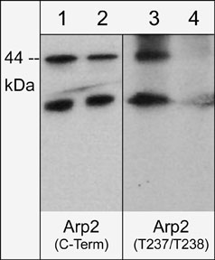 Western blot of human A431 cells treated with Calyculin A (100 nM) for 30 min. Blot lanes were untreated (lanes 1 & 3) or treated with lambda phosphatase (lanes 2 & 4) then probed with anti-Arp2 (C-terminal) (lanes 1 & 2) or anti-Arp2 (T237/T238) (lanes 3 & 4).