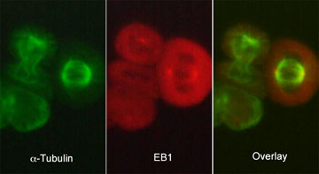 Immunocytochemical labeling of EB1 in paraformaldehyde-fixed and NP40-permeabilized A431 cells. The cells were dual labeled with mouse monoclonal anti-α-Tubulin (TM4111) (left) and rat monoclonal anti-EB1 (EM5041) (middle). The antibodies were detected using either goat anti-mouse:DyLight® 488 (MS3011) or goat anti-Rat:DyLight® 594 (RS3111).