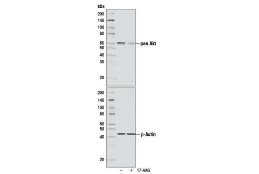 Western blot analysis of extracts from LNCaP cells, untreated (-) or treated with 17-AAG (1 μM, 24 hr), using Akt (pan) (11E7) Rabbit mAb #4685 (upper) and β-Actin (13E5) Rabbit mAb #4970 (lower).