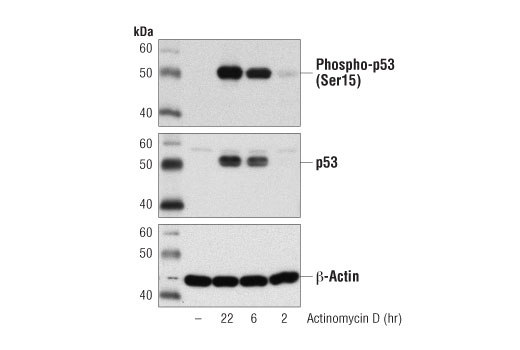 Western blot analysis of extracts from MCF7 cells, untreated (-) or treated with Actinomycin D (1 μM) for the indicated times, using Phospho-p53 (Ser15) Antibody #9284 (upper), p53 (7F5) Rabbit mAb #2527 (middle), and β-Actin (D6A8) Rabbit mAb #8457 (lower).