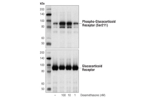 Western blot analysis of extracts from HeLa cells, serum-starved overnight and untreated (-) or treated with Dexamethasone (1 hr) at the indicated concentrations, using Phospho-Glucocorticoid Receptor (Ser211) Antibody #4161 (upper) and Glucocorticoid Receptor (D6H2L) XP ® Rabbit mAb #12041 (lower).