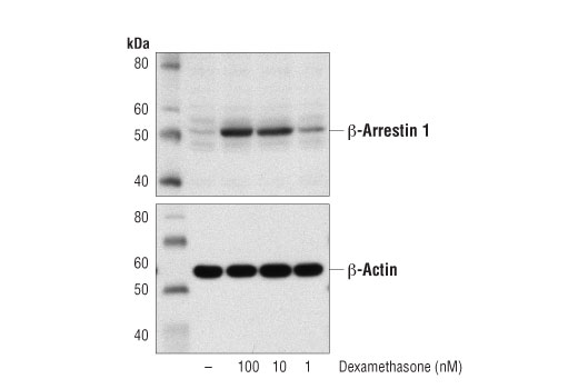 Western blot analysis of extracts from A549 cells, untreated (-) or treated with Dexamethasone (24 hr) at the indicated concentrations, using β-Arrestin 1 (D8O3J) Rabbit mAb #12697 (upper) and β-Actin (D6A8) Rabbit mAb #8457 (lower).