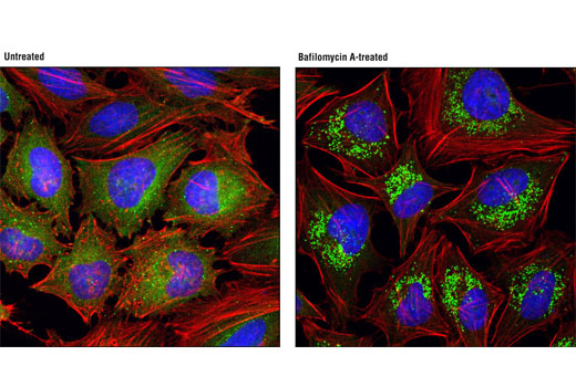 Confocal immunofluorescent analysis of HeLa cells, untreated (left) or treated with Bafilomycin A1 (100 nM, 18 hr; right), using SQSTM1/p62 (D10E10) Rabbit mAb (IF Preferred) #7695 (green). Actin filaments were labeled with DyLight™ 554 Phalloidin #13054. Blue pseudocolor = DRAQ5 ® #4084 (fluorescent DNA dye).
