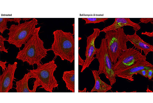 Confocal immunofluorescent analysis of HeLa cells, untreated (left) or treated with Bafilomycin A1 (200 nM, 18 hr; right), using NBR1 (D2E6) Rabbit mAb #9891 (green) and β-Actin (8H10D10) Mouse mAb #3700 (red). Blue pseudocolor = DRAQ5 ® #4084 (fluorescent DNA dye).