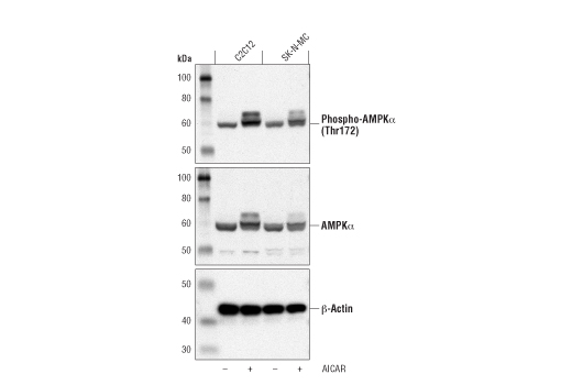 Western Blot analysis of extracts from C2C12 cells, cultured in the presence or absence of serum (O/N) and treated with or without AICAR (0.5 mM, 30 min), using Phospho-AMPKalpha (Thr172) (40H9) Rabbit mAb #2535.
