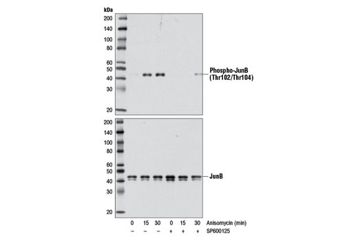 Western blot analysis of extracts from 293T cells, treated with Anisomycin (25 μg/ml) for the indicated times, with or without pretreatment with JNK inhibitor SP600125 (50 μM, 40 min; +), using Phospho-JunB (Thr102/Thr104) (D3C6) Rabbit mAb #8053 (upper) or JunB (C37F9) Rabbit mAb #3753 (lower).