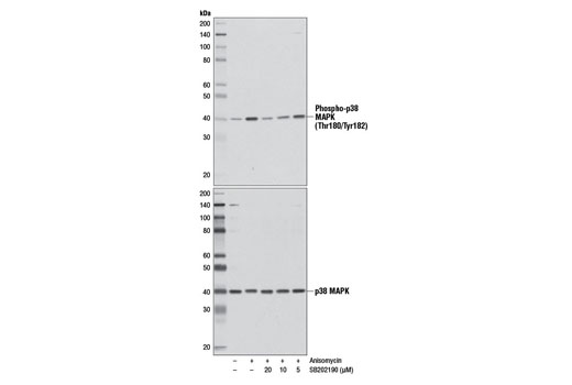 Western blot analysis of extracts from Jurkat cells, serum-starved overnight, pretreated with the indicated concentrations of SB202190 for 1 hr, and subsequently treated with Anisomycin (25 μg/ml, 30 min; +), using Phospho-p38 MAPK (Thr180/Tyr182) (D3F9) XP ® Rabbit mAb #4511 (upper) or p38 MAPK Antibody #9212 (lower).