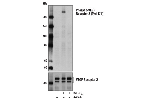 Western blot analysis of extracts from HUVE cells, serum-starved overnight and untreated (-) or pretreated with Axitinib (1 nM, 2 hr; +) prior to treatment with Human Vascular Endothelial Growth Factor-165 (hVEGF 165 ) #8065 (50 ng/ml, 5 min; +), using Phospho-VEGF Receptor 2 (Tyr1175) (19A10) Rabbit mAb #2478 (upper) or VEGF Receptor 2 (55B11) Rabbit mAb #2479 (lower).