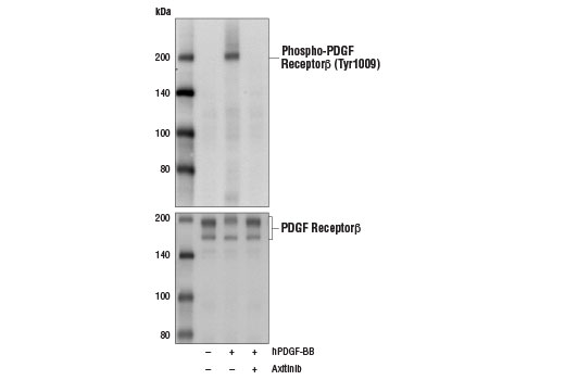 Western blot analysis of extracts from NIH/3T3 cells, serum-starved overnight and untreated (-) or pretreated with Axitinib (100 nM, 2 hr; +) prior to treatment with Human Platelet-Derived Growth Factor BB (hPDGF-BB) #8912 (100 ng/ml, 5 min; +), using Phospho-PDGF Receptor β (Tyr1009) (42F9) Rabbit mAb #3124 (upper) or PDGF Receptor β (28E1) Rabbit mAb #3169 (lower).